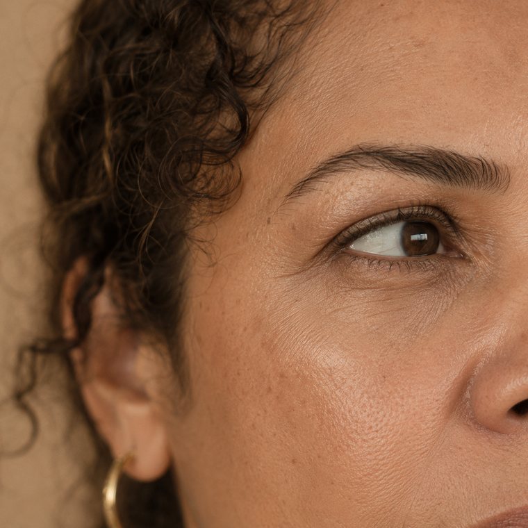Região abaixo dos olhos de uma mulher madura, área tratada na blefaroplastia inferior